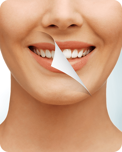 Cosmetic Dentistry | Evershine Dental Care | Family & General Dentist | SE Calgary