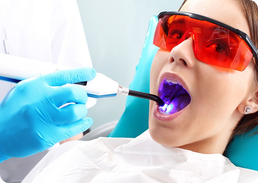 Cosmetic Tooth Bonding | Evershine Dental Care | Family & General Dentist | SE Calgary