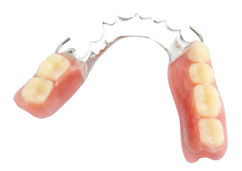 Partial Dentures | Evershine Dental Care | Family & General Dentist | SE Calgary