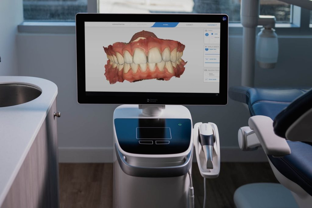 Oral Digital Scanner | Evershine Dental Care | Family & General Dentist | SE Calgary