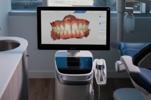 Oral Digital Scanner | Evershine Dental Care | Family & General Dentistry Calgary